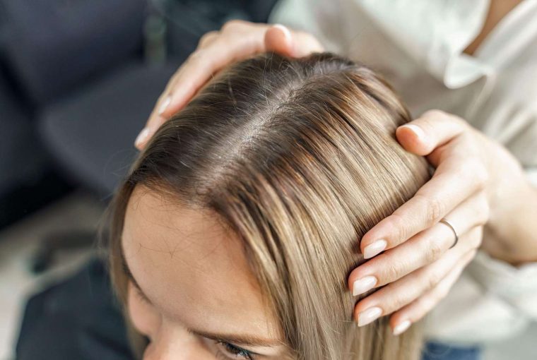 Understanding Hair Loss and Treatment Options - treatment, transplants, steroid injections, medication, hair loss, diet