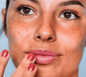 Thinking About a Lip Flip? Here's Why It Might Just Be Your Next Beauty Move - Lip flip, lip fillers, Cosmetic procedure, botox, Beauty enhancement